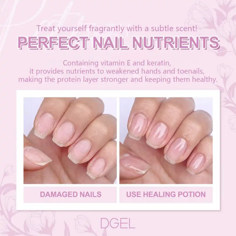 A delicate, relaxing fragrance infuses this DGEL Healing Potion, formulated with vitamin E and keratin to nourish and strengthen weakened hands and toenails, restoring a natural shine and healthier appearance.