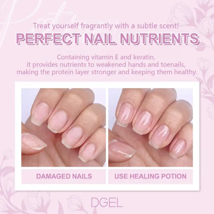 A delicate, relaxing fragrance infuses this DGEL Healing Potion, formulated with vitamin E and keratin to nourish and strengthen weakened hands and toenails, restoring a natural shine and healthier appearance.