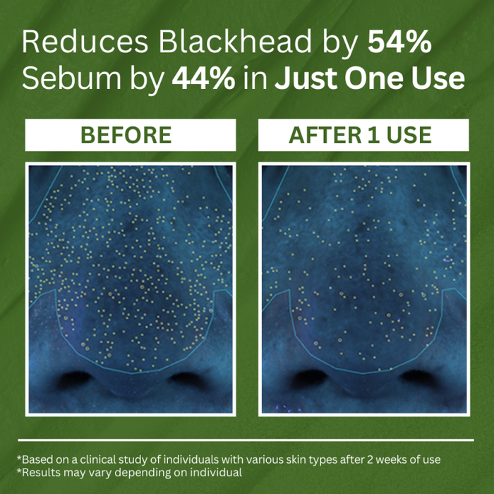 P.CALM HB-002 Holy Basil Sparking Bubble Mask 90g - Skin Care