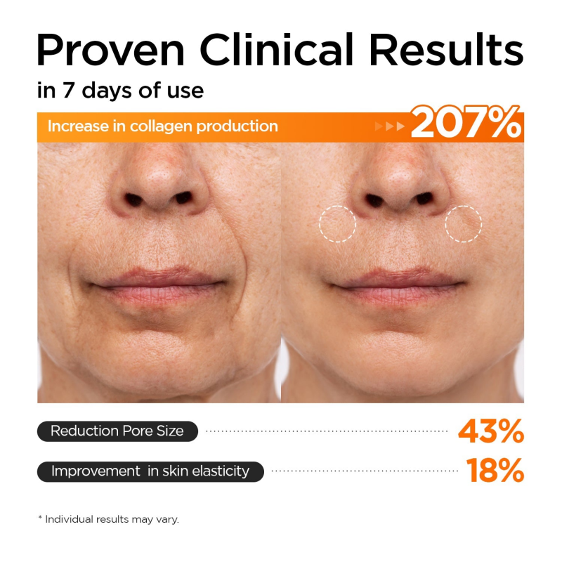 P.CALM RN-001 RETINOLAGEN Pore Tightening SERUM[AMPOULE] - Skin Care