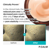 P.CALM RN-002 RETINOLAGEN Pore Tightening Cream - Skin Care